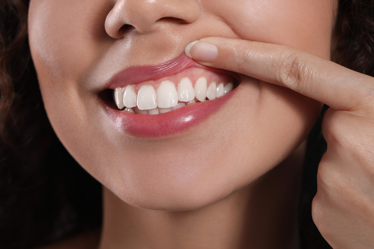Young woman showing healthy gums to represent reasons to visit a periodontal specialist.