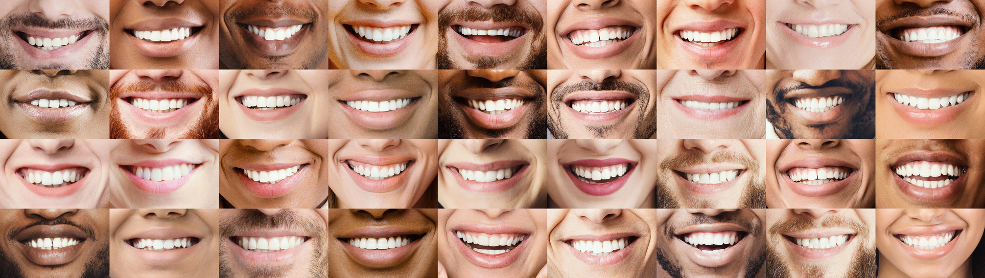 Close up of many multiethnic smiles as the featured image for How Does Gum Color Reflect Oral Health